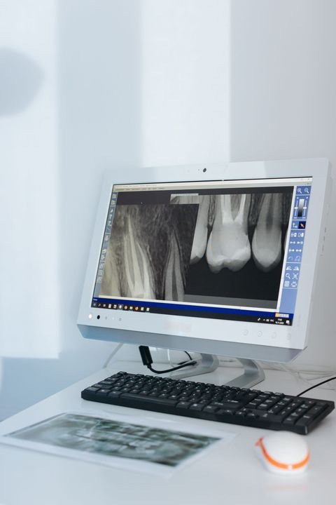 Diagnóstico por imagen dental