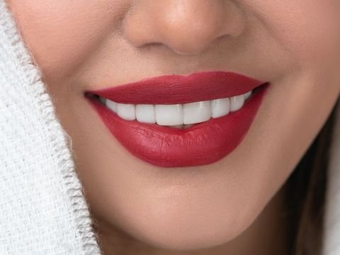 Diseño de Sonrisa
